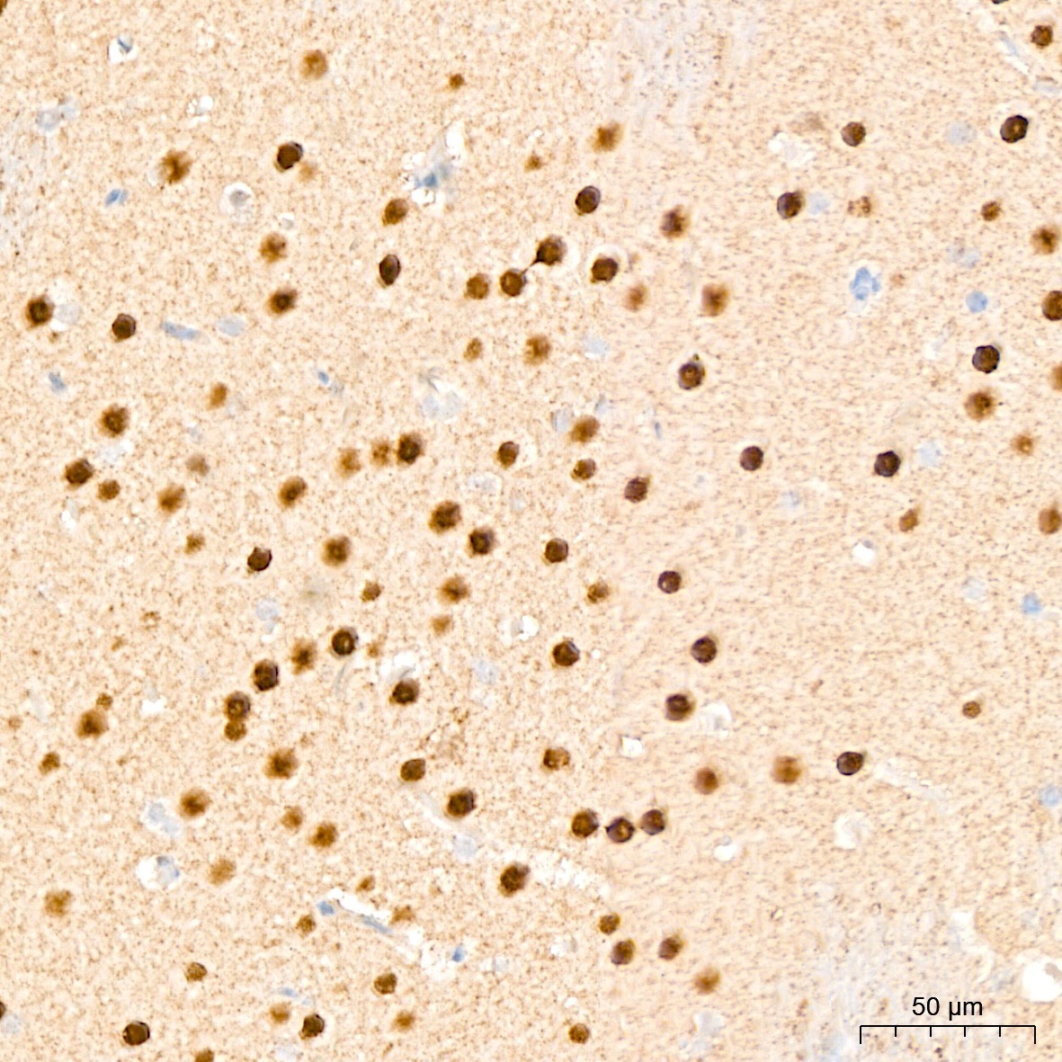DYRK2 Rabbit Polyclonal Antibody - Image 2