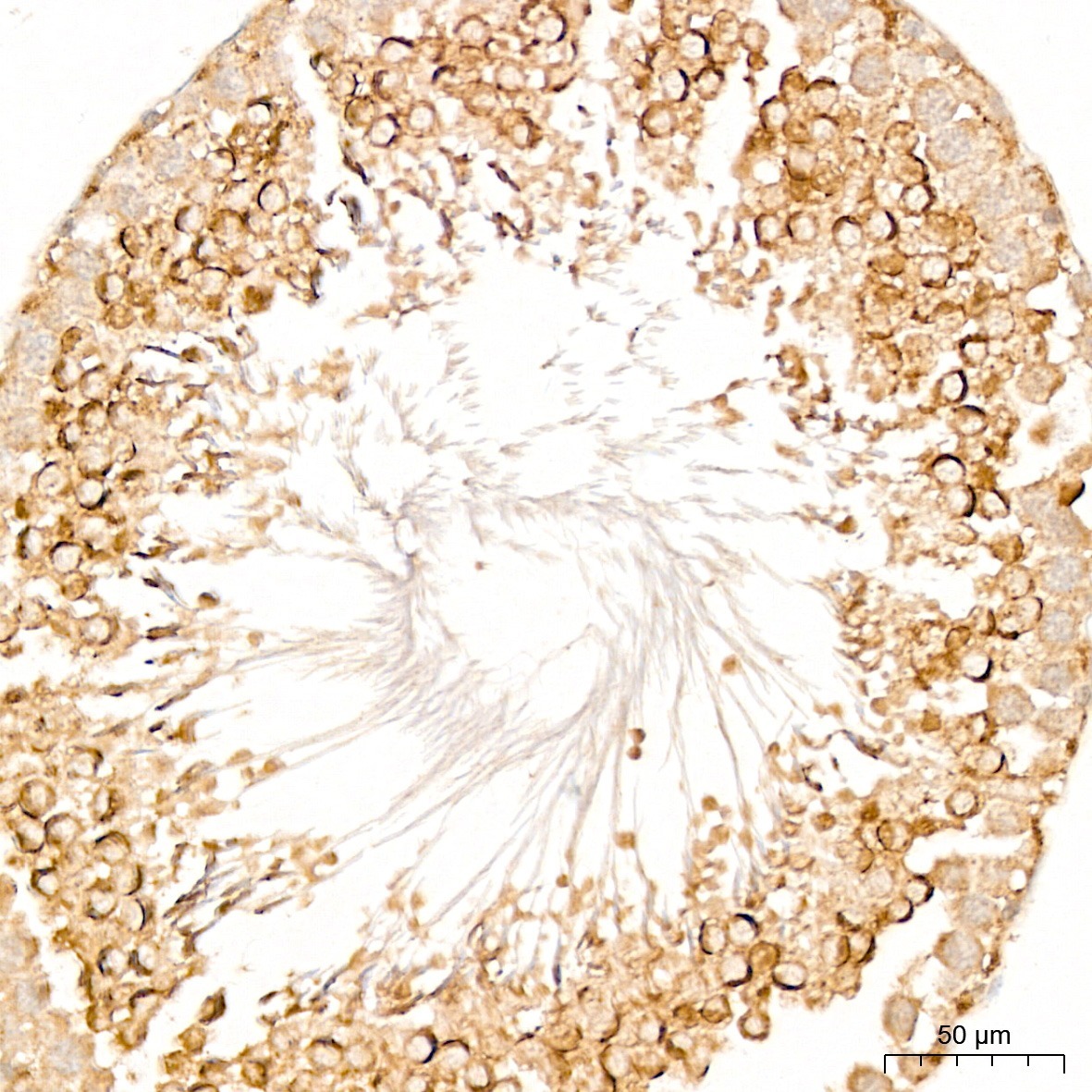 DYRK2 Rabbit Polyclonal Antibody - Image 3