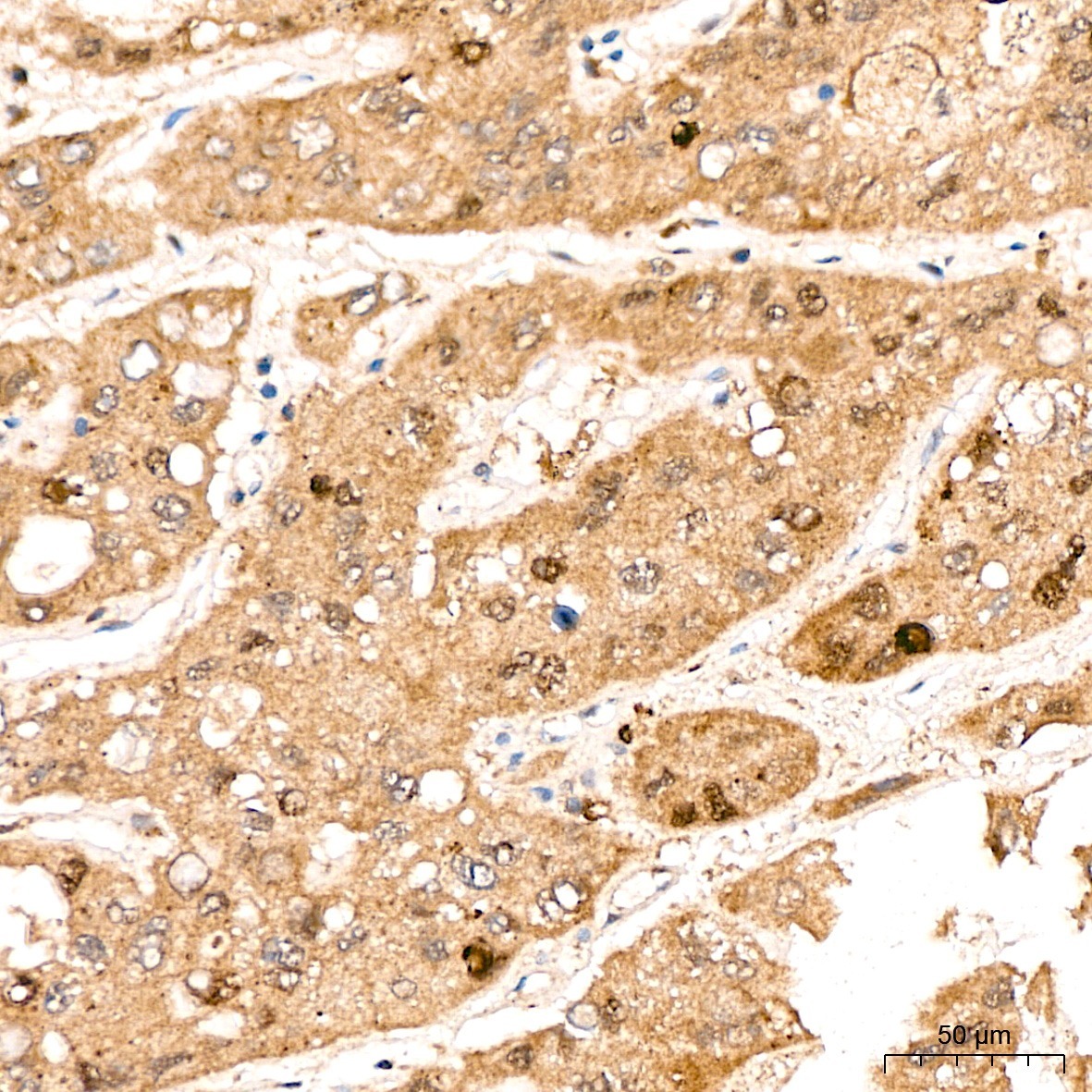 DYRK2 Rabbit Polyclonal Antibody - Image 4
