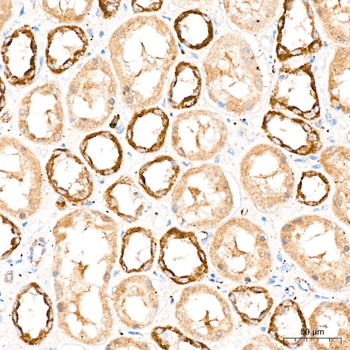 DYRK2 Rabbit Polyclonal Antibody - Image 5