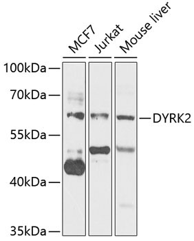 DYRK2 Rabbit Polyclonal Antibody