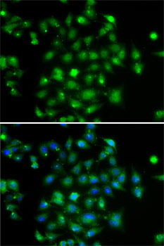 DYRK2 Rabbit Polyclonal Antibody - Image 2