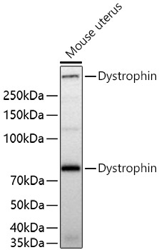 Dystrophin Rabbit Monoclonal Antibody