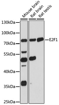 E2F1 Rabbit Polyclonal Antibody
