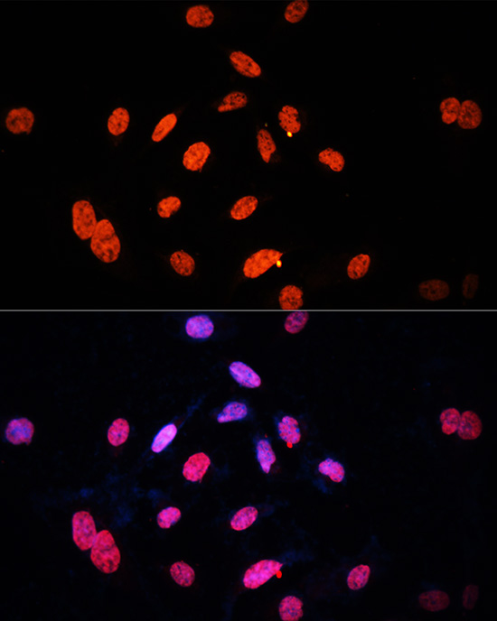 E2F1 Rabbit Polyclonal Antibody