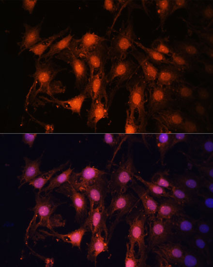 E2F1 Rabbit Polyclonal Antibody - Image 2
