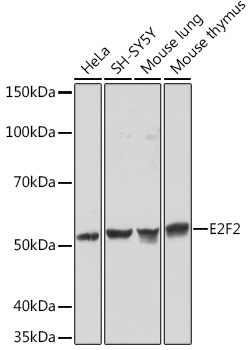 E2F2 Rabbit Monoclonal Antibody