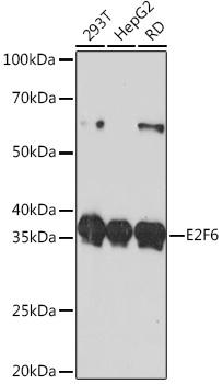 E2F6 Rabbit Monoclonal Antibody