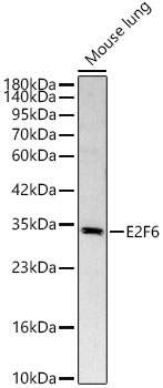 E2F6 Rabbit Polyclonal Antibody