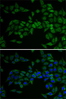 E2F6 Rabbit Polyclonal Antibody - Image 2
