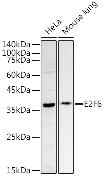 E2F6 Rabbit Polyclonal Antibody