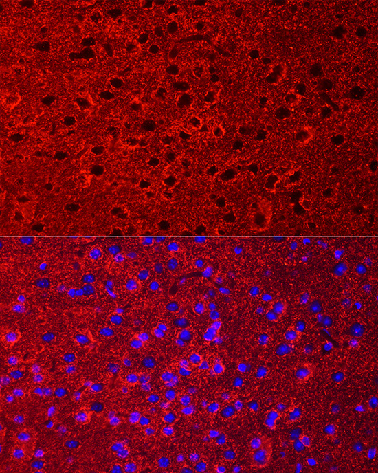 EAAT2/SLC1A2 Rabbit Polyclonal Antibody