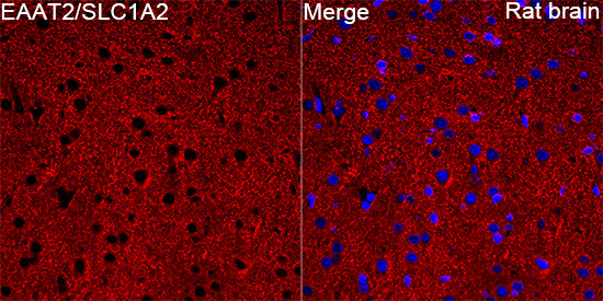 EAAT2/SLC1A2 Rabbit Polyclonal Antibody - Image 2