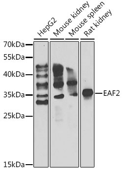 EAF2 Rabbit Polyclonal Antibody