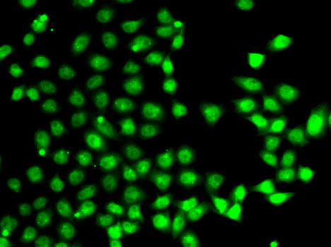 EAF2 Rabbit Polyclonal Antibody - Image 2
