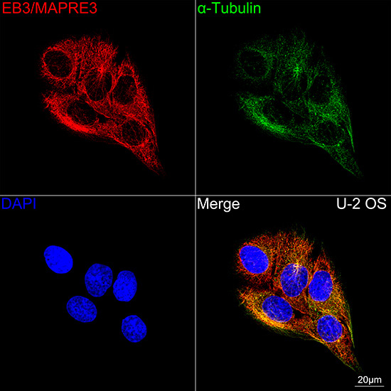 EB3/MAPRE3 Rabbit Monoclonal Antibody - Image 2