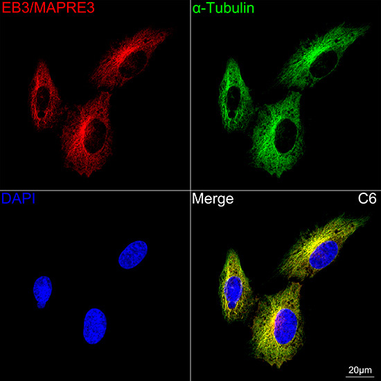 EB3/MAPRE3 Rabbit Monoclonal Antibody - Image 3