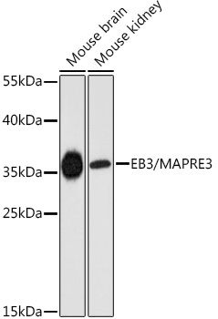 EB3/MAPRE3 Rabbit Polyclonal Antibody