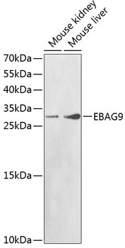 EBAG9 Rabbit Polyclonal Antibody