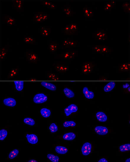 EBNA1BP2 Rabbit Polyclonal Antibody - Image 2