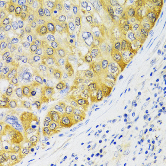 EBP1/PA2G4 Rabbit Polyclonal Antibody - Image 3