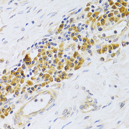 EBP1/PA2G4 Rabbit Polyclonal Antibody - Image 4