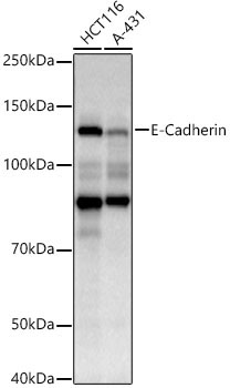 E-Cadherin Mouse Monoclonal Antibody