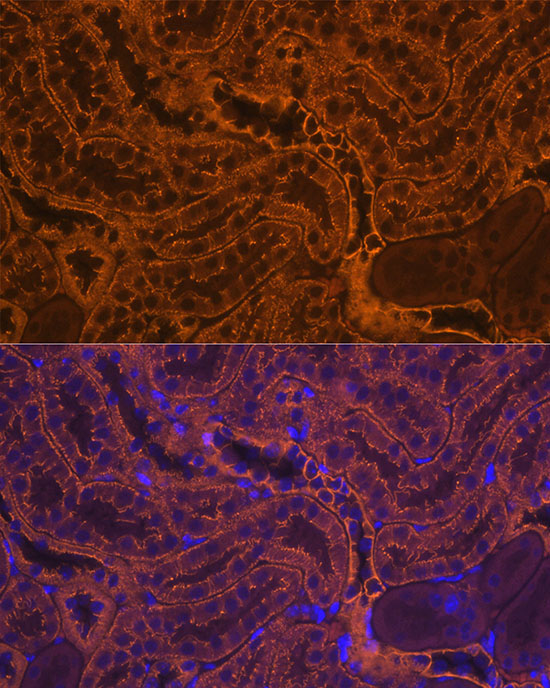E-Cadherin Mouse Monoclonal Antibody - Image 2