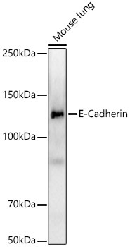 E-Cadherin Rabbit Monoclonal Antibody