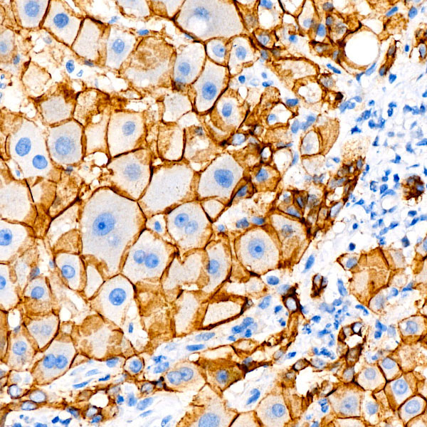 E-Cadherin Rabbit Monoclonal Antibody - Image 2