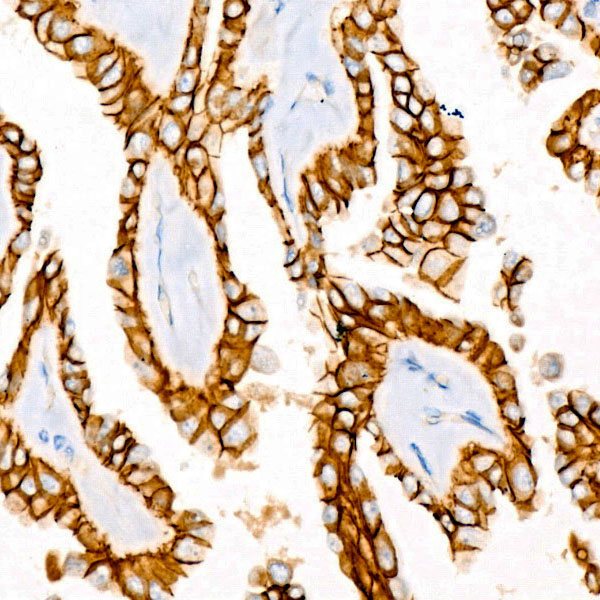 E-Cadherin Rabbit Monoclonal Antibody - Image 3