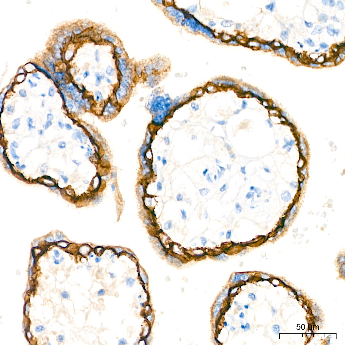 E-Cadherin Rabbit Monoclonal Antibody - Image 4