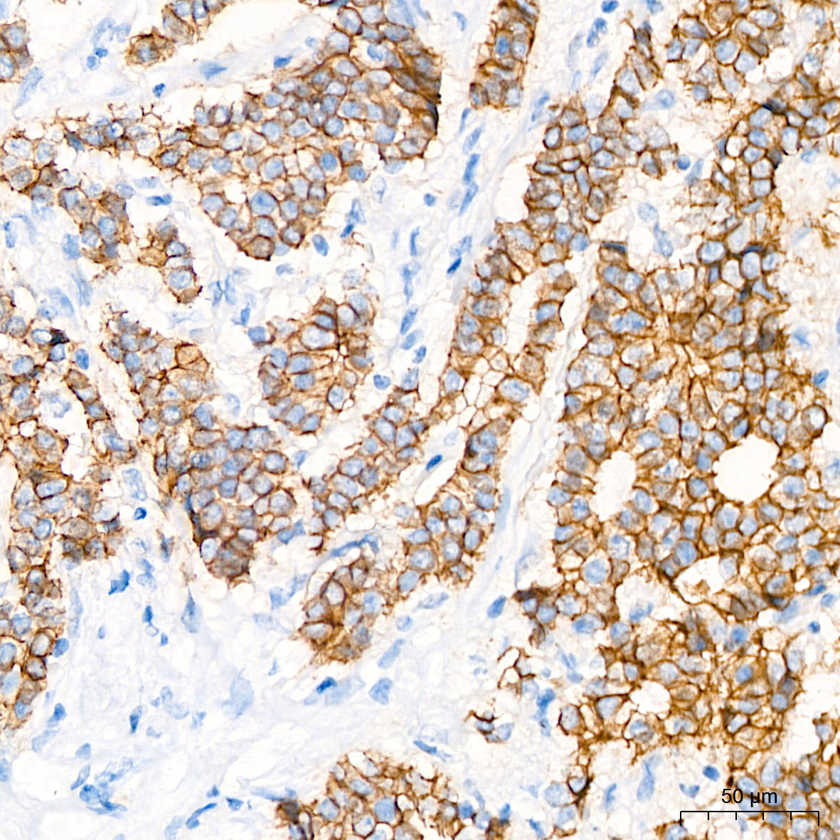 E-Cadherin Rabbit Monoclonal Antibody - Image 5