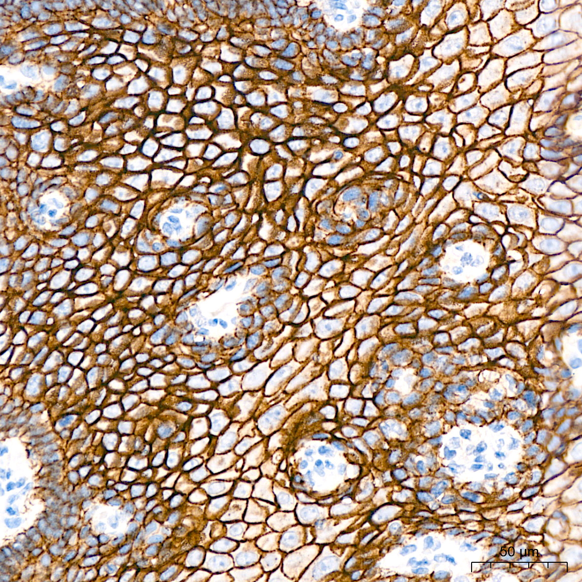 E-Cadherin Rabbit Monoclonal Antibody - Image 6