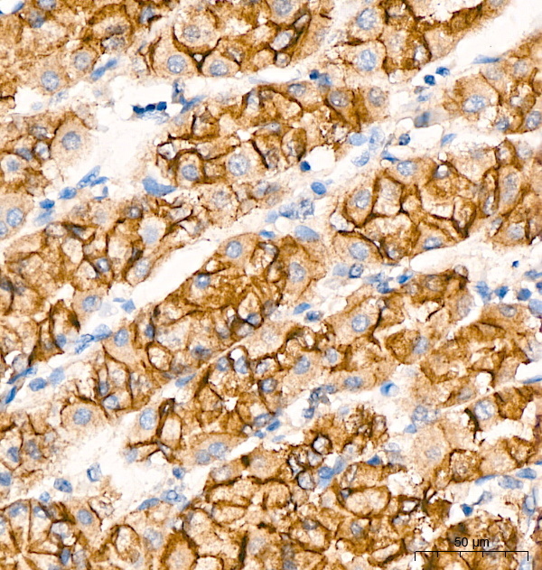E-Cadherin Rabbit Monoclonal Antibody - Image 7