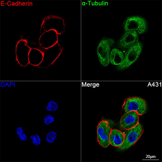 E-Cadherin Rabbit Monoclonal Antibody - Image 8