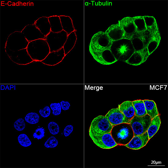 E-Cadherin Rabbit Monoclonal Antibody - Image 9
