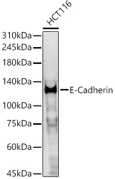 E-Cadherin Rabbit Polyclonal Antibody