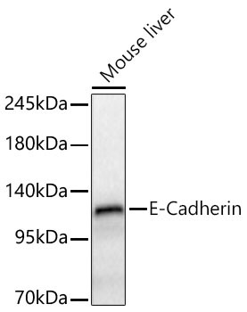 E-Cadherin Rabbit Polyclonal Antibody - Image 2
