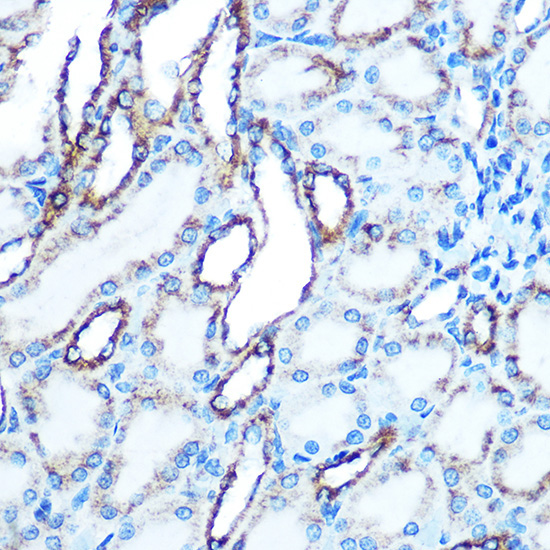 E-Cadherin Rabbit Polyclonal Antibody - Image 3