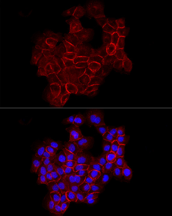 E-Cadherin Rabbit Polyclonal Antibody - Image 4