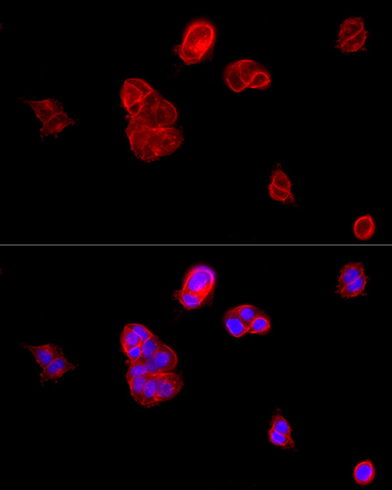 E-Cadherin Rabbit Polyclonal Antibody - Image 5