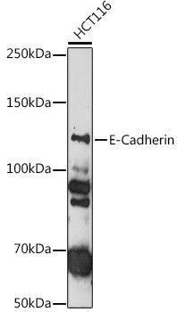E-Cadherin Rabbit Polyclonal Antibody