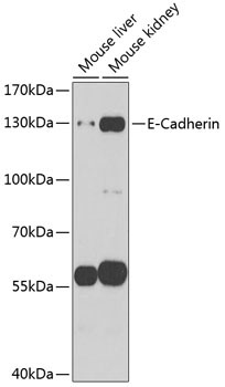 E-Cadherin Rabbit Polyclonal Antibody