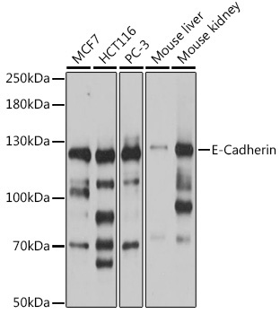 E-Cadherin Rabbit Polyclonal Antibody