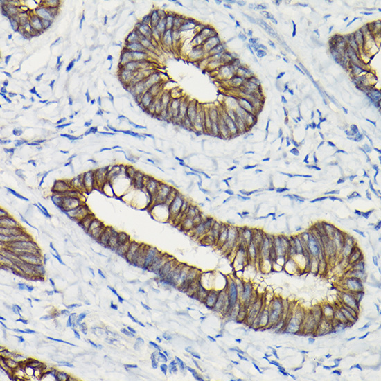 E-Cadherin Rabbit Polyclonal Antibody - Image 2