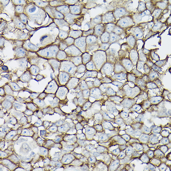 E-Cadherin Rabbit Polyclonal Antibody - Image 3