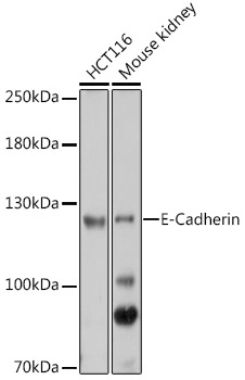 E-Cadherin Rabbit Polyclonal Antibody