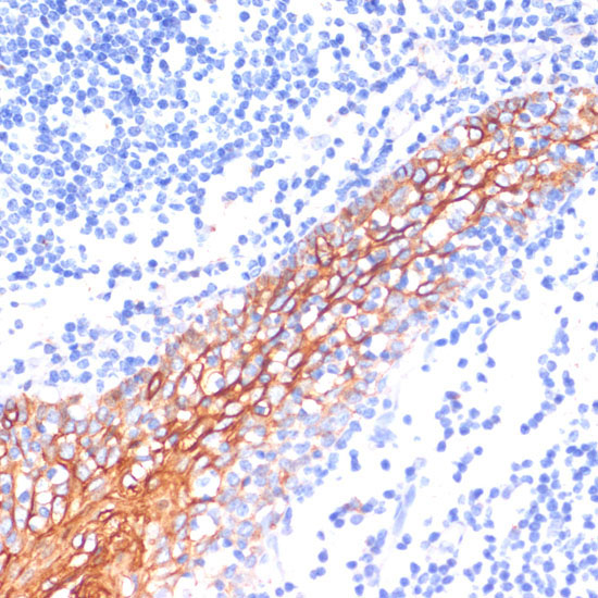 E-Cadherin Rabbit Polyclonal Antibody - Image 2