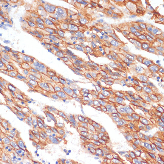 E-Cadherin Rabbit Polyclonal Antibody - Image 3
